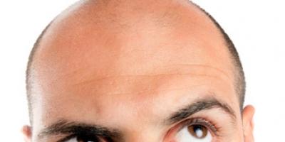 0692a4e584defe6544ca2abbf7dd2502_l 0692a4e584defe6544ca2abbf7dd2502_l